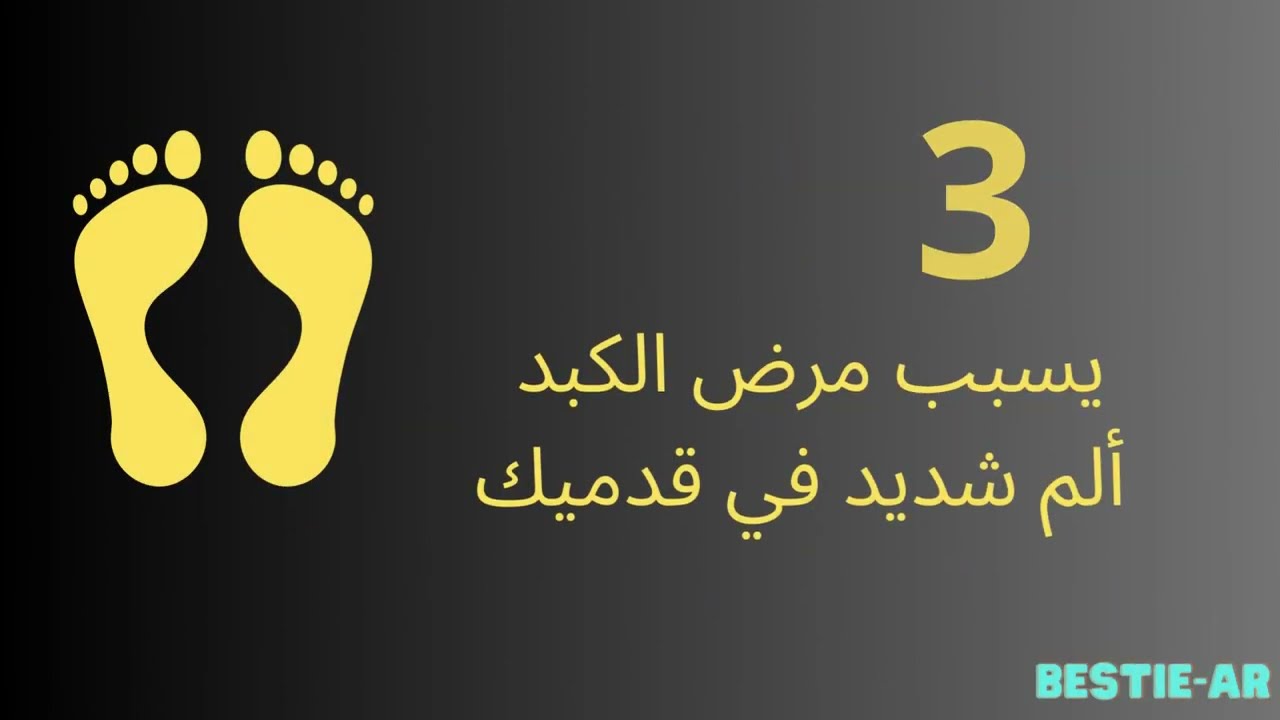 التحميل المسبق صورة